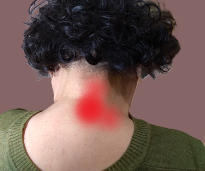 NECK PAIN